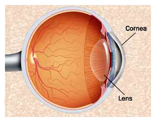 top rated cataract surgeon arizona
