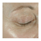arizona obagi skin elastin gilbert