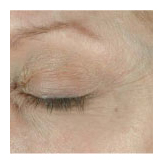 arizona obagi skin elastin tempe