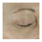 arizona obagi skin elastin scottsdale