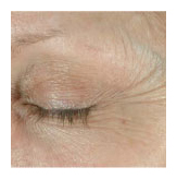 arizona obagi skin elastin mesa