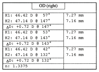 Alcon AcrySof Toric IOL - IOLMaster K's