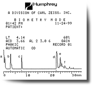 contact a-scan biometry - iol power calculations