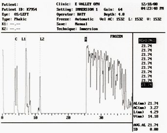 1532 immersion a-scan