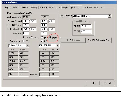 IOLMaster online manual screen shot