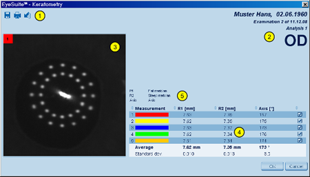 K Measurement Details Overview LENSTAR Biometry