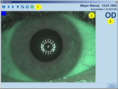 Details Overview LENSTAR Biometry