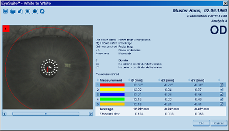 White to White Details Measurements LENSTAR Biometry