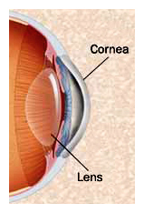 cataract surgeon arizona
