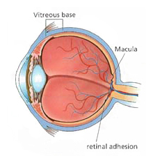vitreous detachment arizona eye doctor
