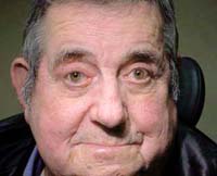 Patient 8 After Eyelid Surgery Mesa Arizona