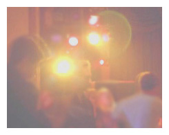 best eye surgeon arizona scottsdale phoenix