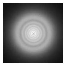 IQ lens implant arizona