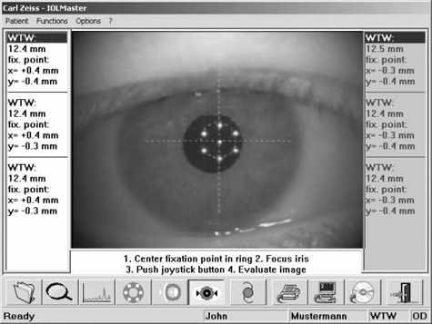 IOLMaster white to white measurement