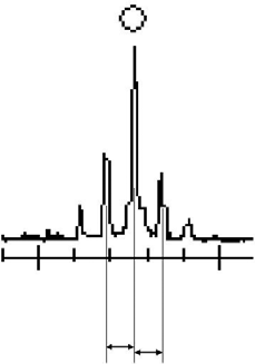 IOLMaster Axial Length Measurements